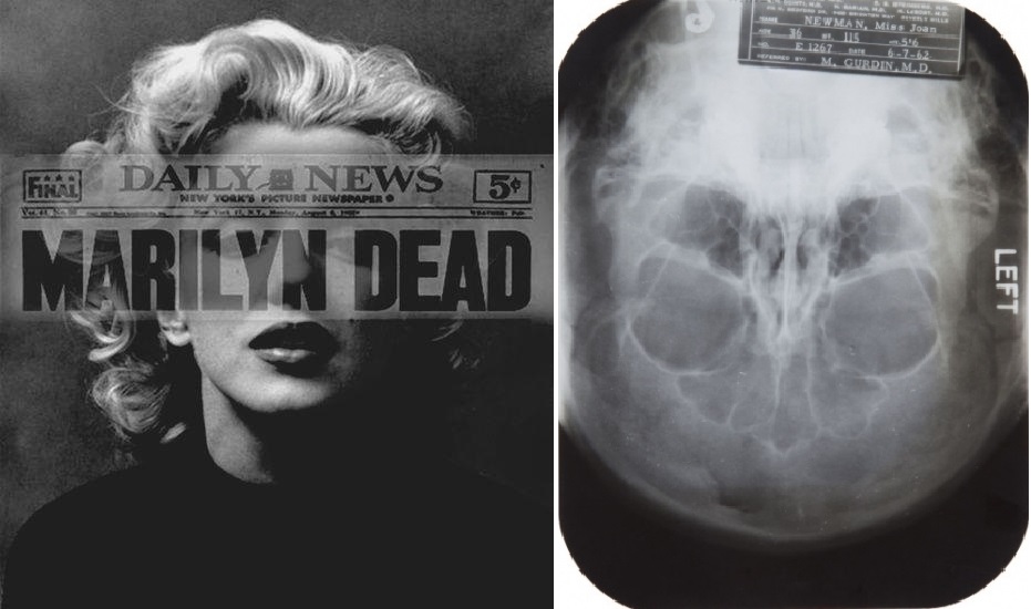 Montage : à gauche Marilyn Monroe,; à droite une des radios issues des rapports médicaux en vente aux enchères en Novembre 2013 par la maison Julien's Auctions